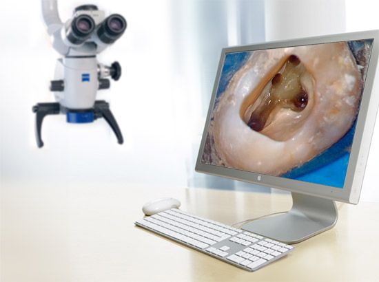 microscop dentar